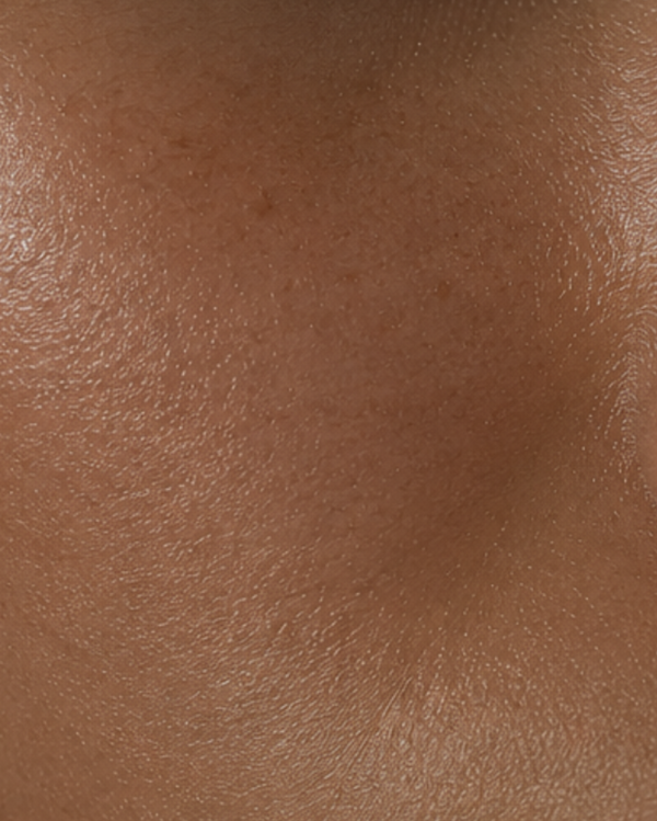 Close-up of skin texture